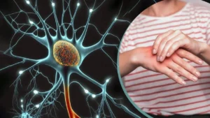 Read more about the article Guillain-Barre Syndrome (GBS): Symptoms, Causes, Precautions, Treatment, and Complications